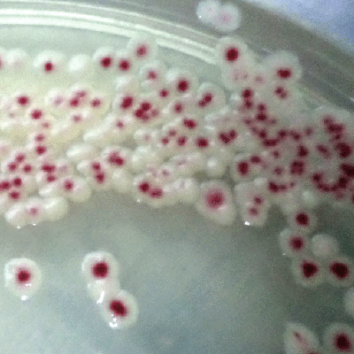 serratia marcescens bacteria